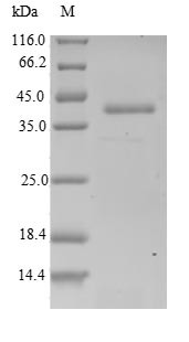 Actin-related protein 2/3 complex subunit 5-like protein (ARPC5L), human, recombinant