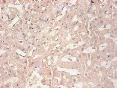 Anti-FTL Monoclonal, clone 1A2C5