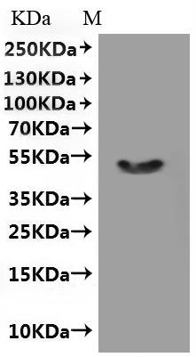 Transient receptor potential cation channel subfamily M member 8 (TRPM8), partial-VLPs, human, recom