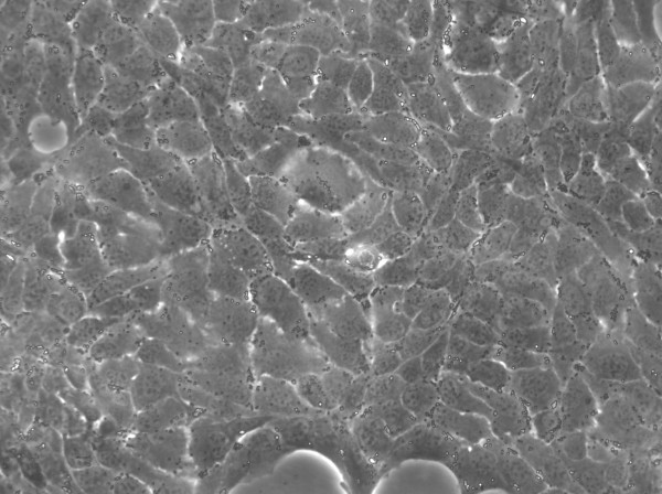 Hep-CLS-E1 Cells