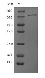 Protein phosphatase 1 regulatory subunit 15A (PPP1R15A), partial, human, recombinant