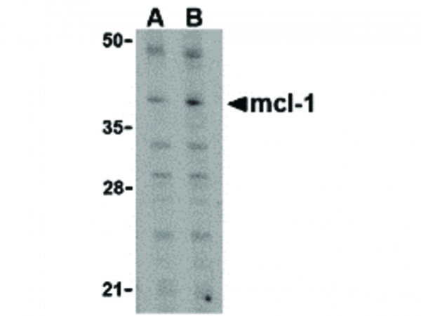 Anti-Mcl-1