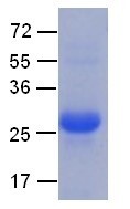 Rab7 (Member RAS oncogene family, Rab7a, MGC102153), human, recombinant full length, His6-tag [E. co