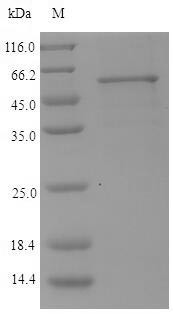 Lys-gingipain (kgp), partial, Porphyromonas gingivalis, recombinant