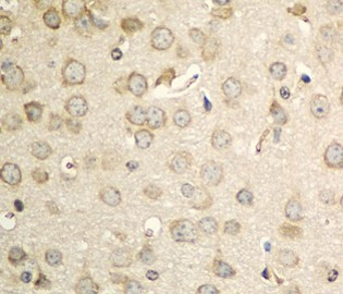Anti-OB Cadherin