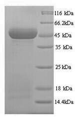 Protein Wnt-10a (WNT10A), human, recombinant