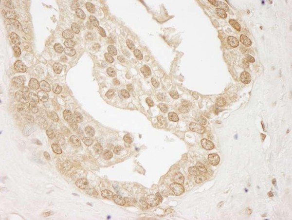 Anti-AKT1 (IHC)