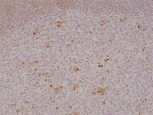 Anti-OX40 (human), Rabbit Monoclonal (RM313)