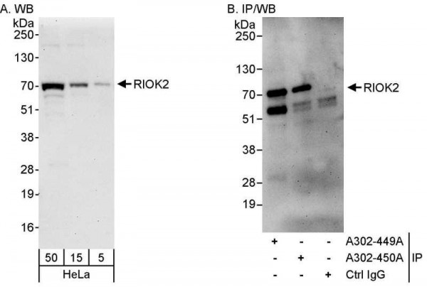 Anti-RIOK2