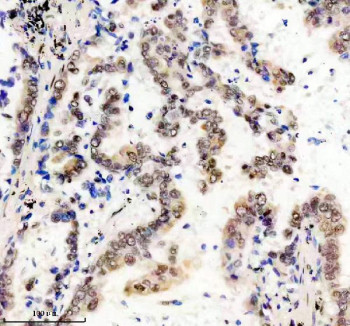 Anti-FTO / Fat mass and obesity associated protein, clone AEAA-6