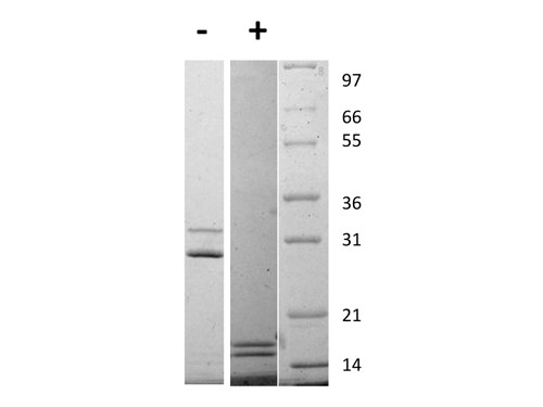 Interleukin-17AF Heterodimer