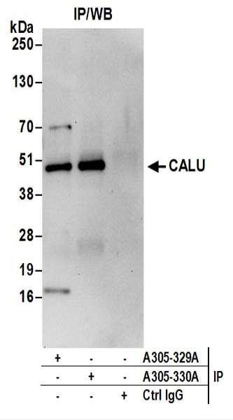 Anti-CALU
