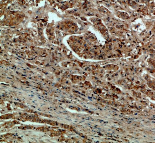 Anti-DCT / TRP2