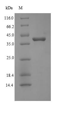 Protein Wnt-2 (WNT2), human, recombinant