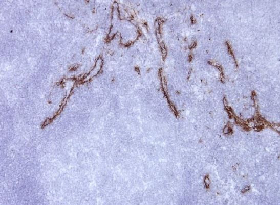 Anti-CD206 / MMR, clone 15-2