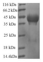 60S ribosomal protein L35 (RPL35), human, recombinant