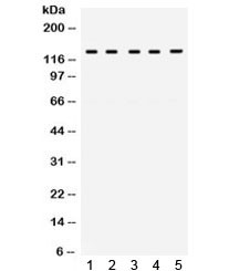 Anti-TRPM8