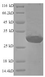 Endothelin-1 (EDN1), partial, recombinant human