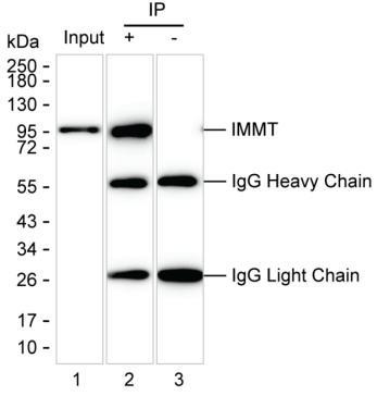 Anti-IMMT