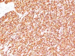 Anti-CD45 (Leukocyte marker), clone SPM570