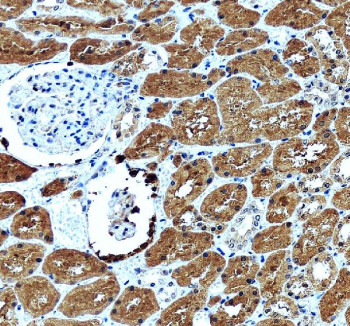 Anti-GLRX / Glutaredoxin 1