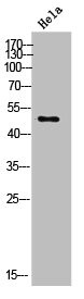 Anti-KCNJ16