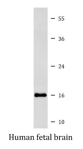 Anti-gamma Sarcoglycan