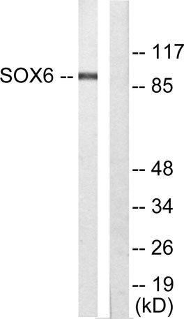 Anti-Sox-6