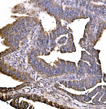 Anti-HIP1R / Huntingtin-interacting protein 1-related protein