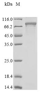 Protein CBFA2T1 (RUNX1T1), human, recombinant
