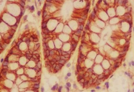 Anti-CD46