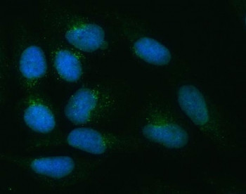 Anti-ZNRF3 / Zinc/RING finger protein 3