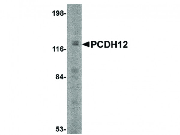 Anti-PCDH12