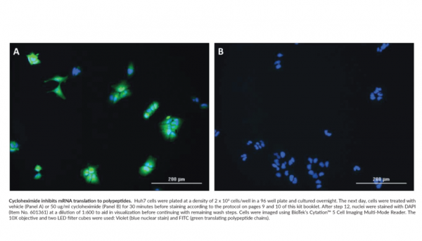 Protein Synthesis Assay Kit