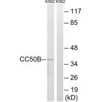 Anti-TMEM30B