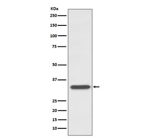 Anti-CD74 / CLIP, clone AOIF-3