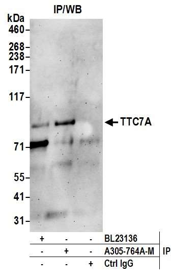 Anti-TTC7A