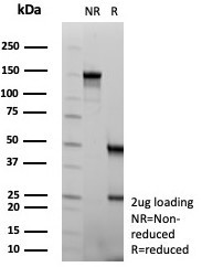 Anti-NSE / Neuron Specific Enolase, clone rENO/8684