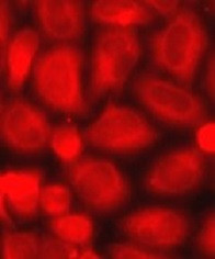 Anti-LDHA / Lactate Dehydrogenase