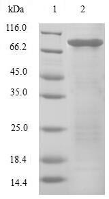 Eukaryotic translation initiation factor 3 subunit E (EIF3E), human, recombinant