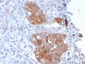 Anti-Desmoglein 1 / DSG1, clone 32-2B