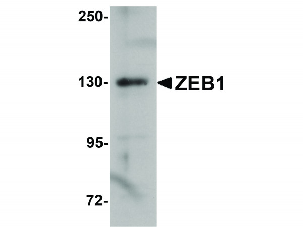 Anti-ZEB1