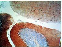 Anti-S100 Protein