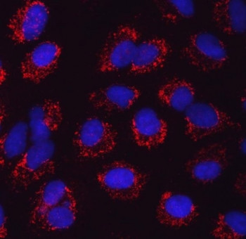 Anti-SARS2 / SerRS / Seryl-tRNA synthetase