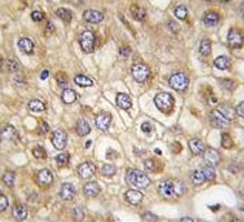 Anti-Claudin 2 (CLDN2)