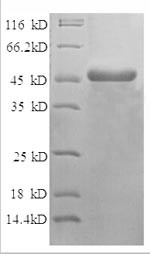 NADH dehydrogenase [ubiquinone] flavoprotein 2, mitochondrial (NDUFV2),partial, human, recombinant