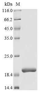 AP-3 complex subunit beta-2 (AP3B2), partial, human, recombinant