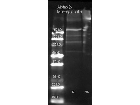 Anti-alpha-2-MACROGLOBULIN (Human Plasma), Biotin Conjugated