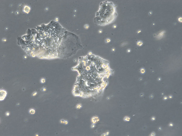 HROC126 Cells