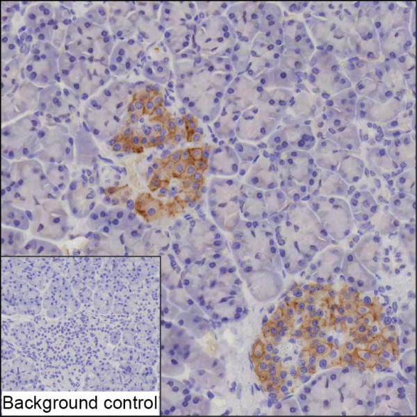 Anti-ENTPD3